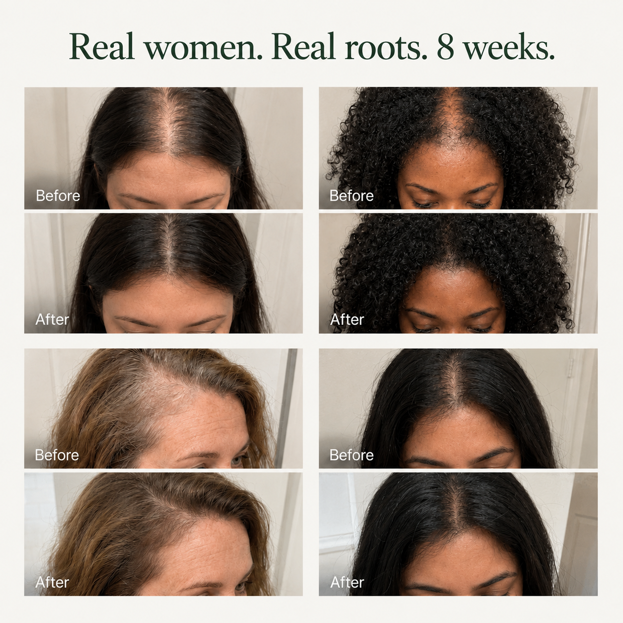 Korean Scalp Renewal Bar
