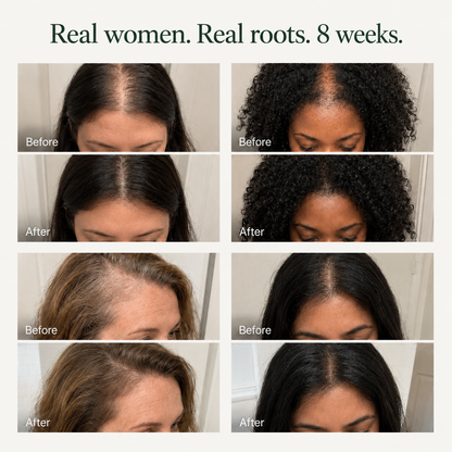 Korean Scalp Renewal Bar